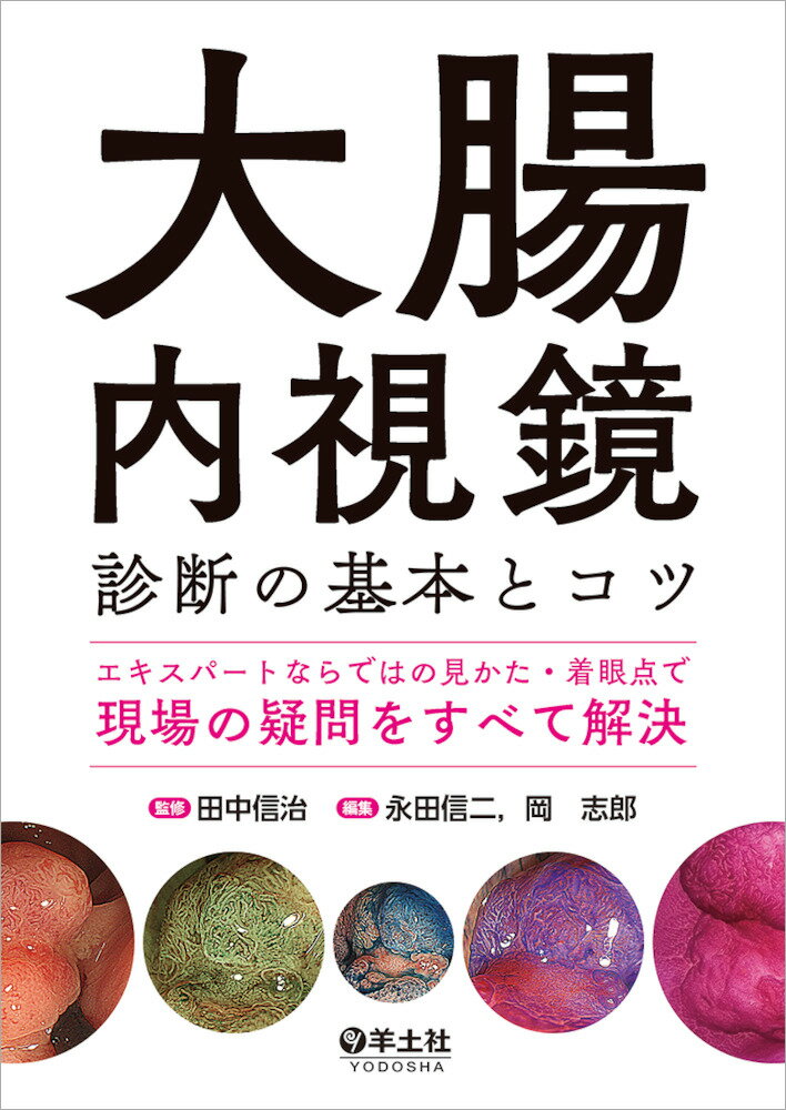 大腸内視鏡診断の基本とコツ [ 田中　信治 ]