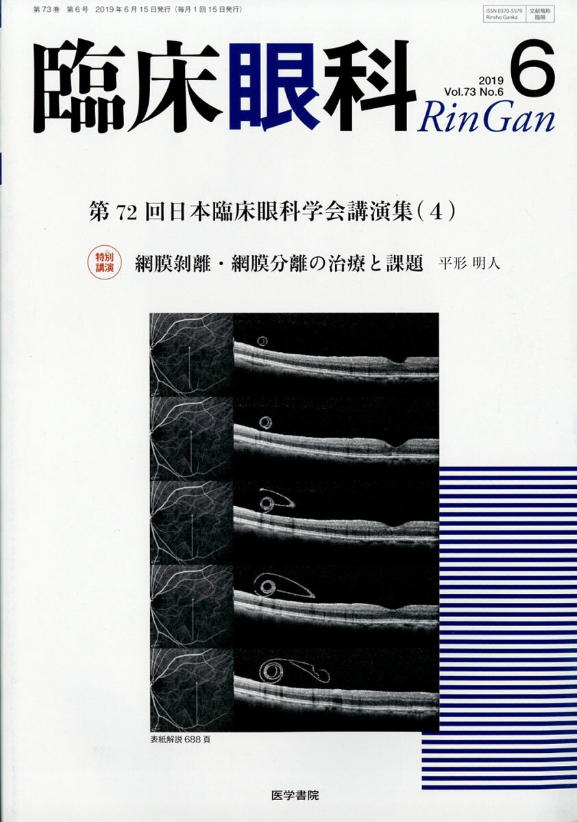 臨床眼科 2019年 06月号 [雑誌]