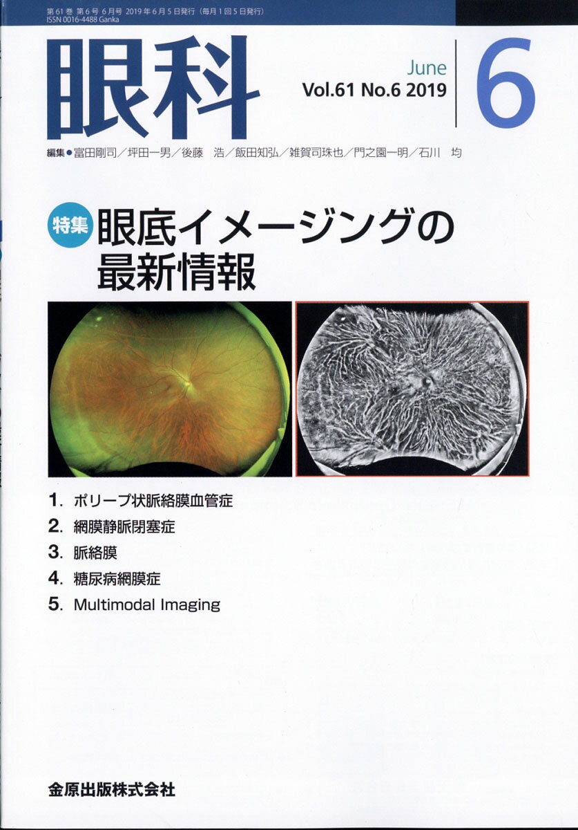 眼科 2019年 06月号 [雑誌]