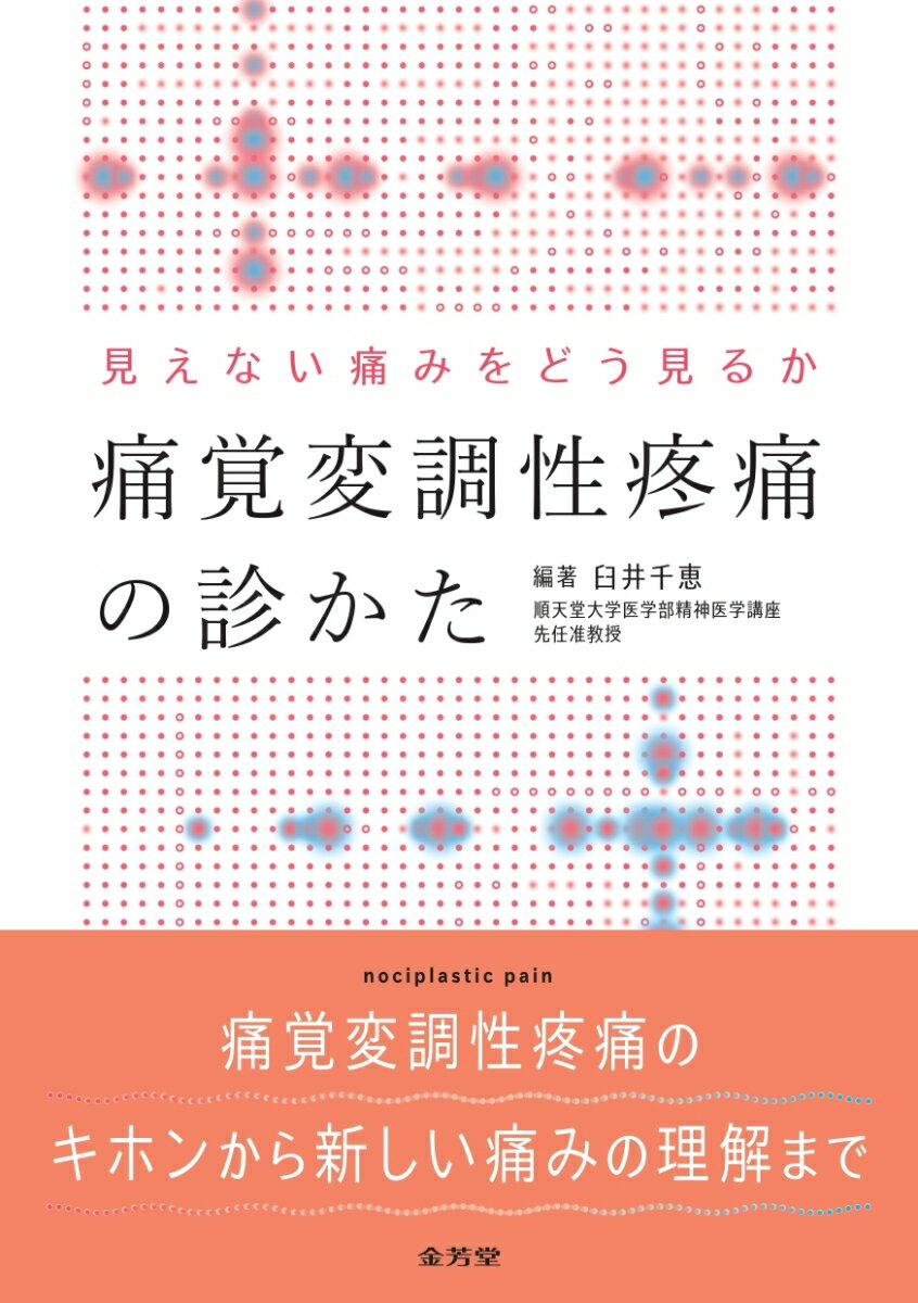 見えない痛みをどう見るか　痛覚変調性疼痛の診かた