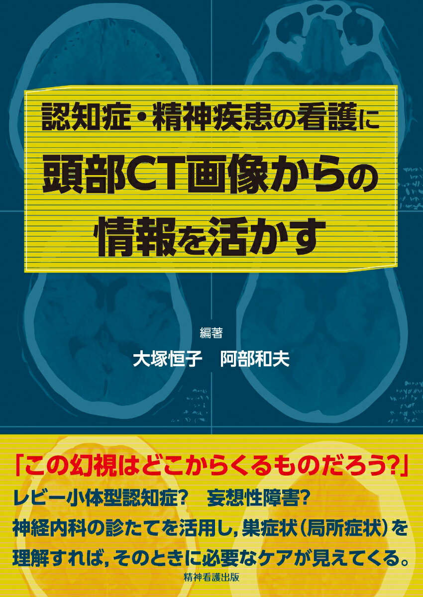 認知症・精神疾患の看護に頭部CT画像からの情報を活かす