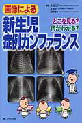 画像による新生児症例カンファランス