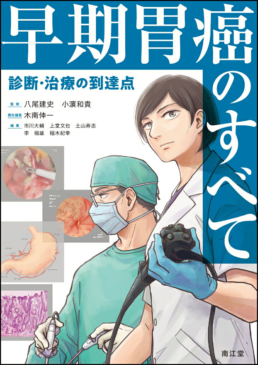 早期胃癌のすべて