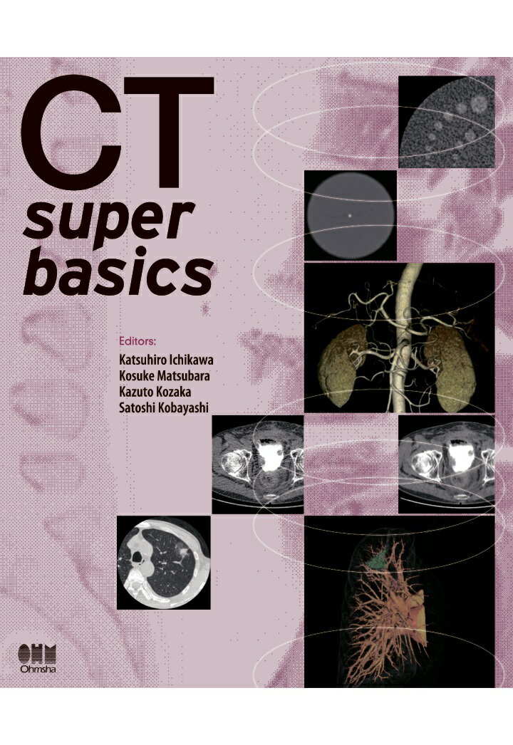 【POD】CT super basics