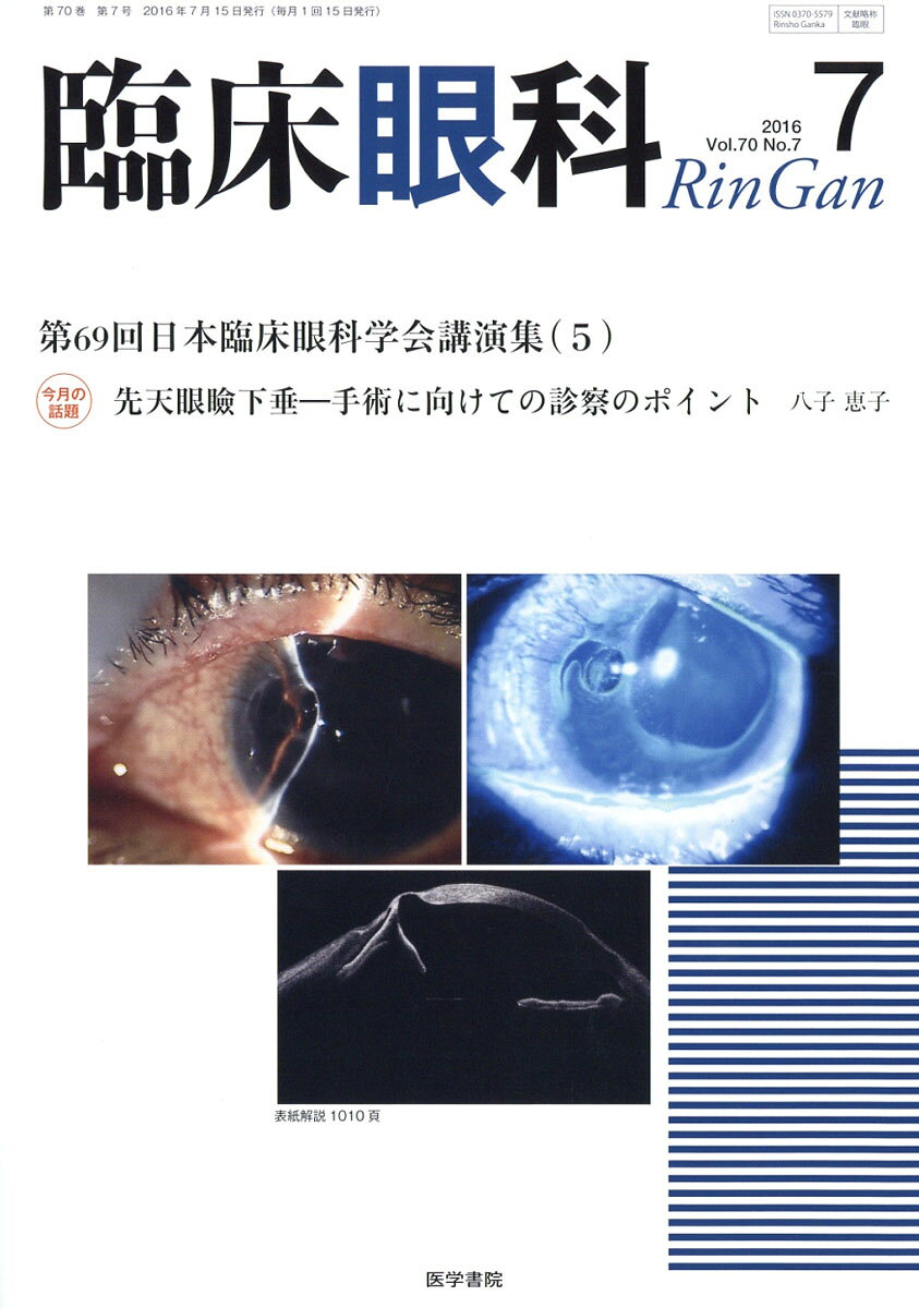 臨床眼科 2016年 07月号 [雑誌]