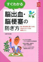 すぐわかる脳出血・脳梗塞の防ぎ方