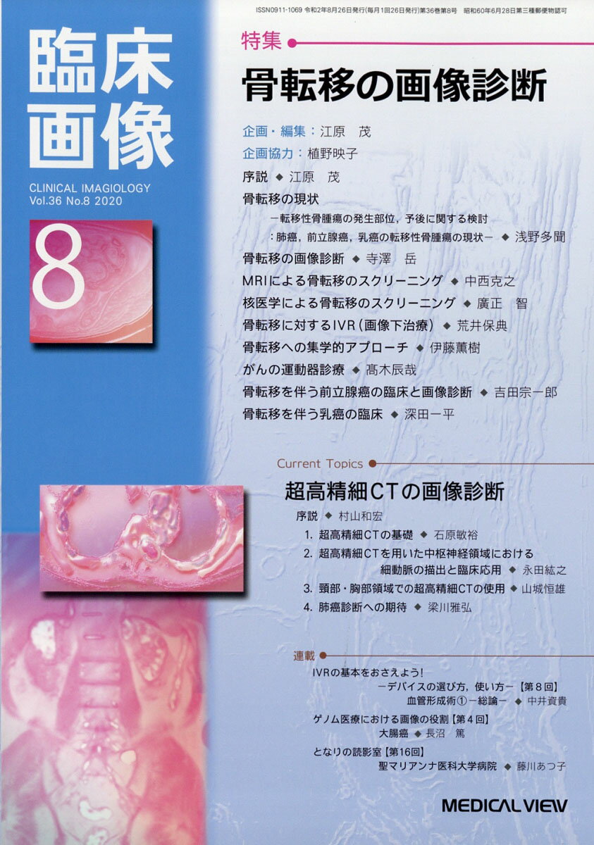臨床画像 2020年 08月号 [雑誌]