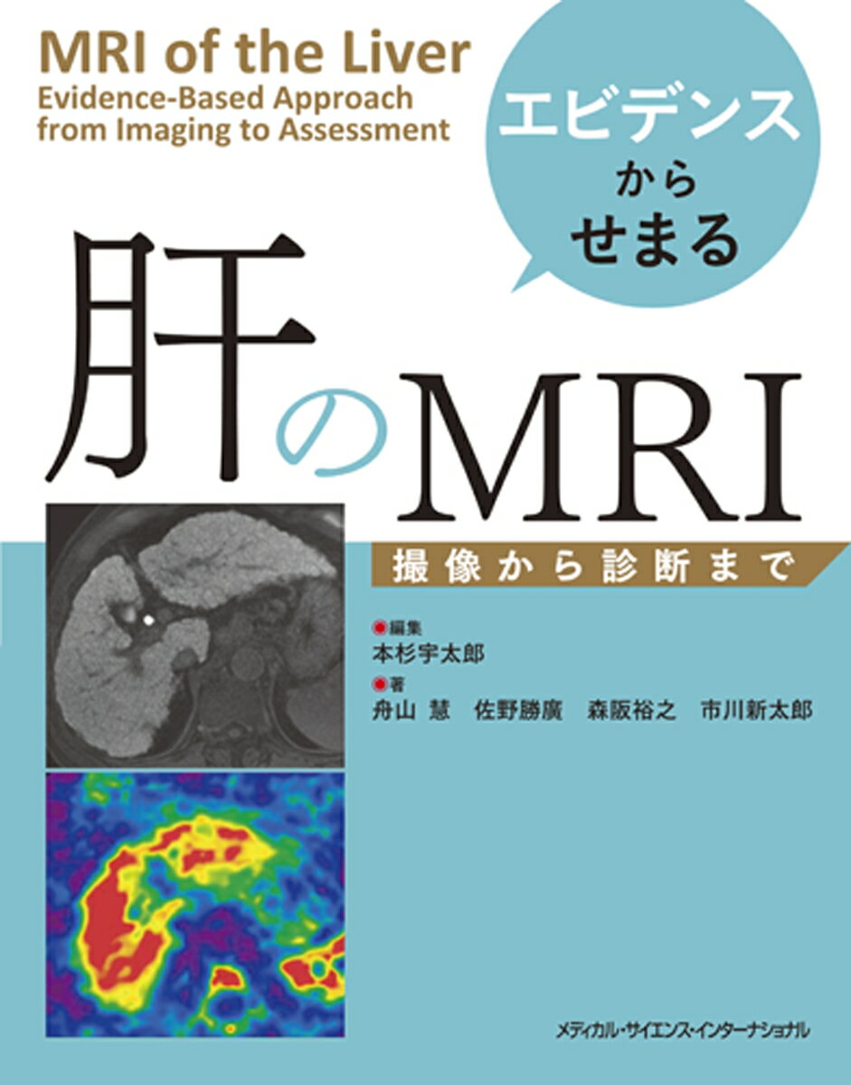 エビデンスからせまる 肝のMRI