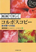 動画で学ぶコルポスコピー