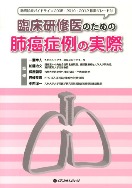 臨床研修医のための肺癌症例の実際