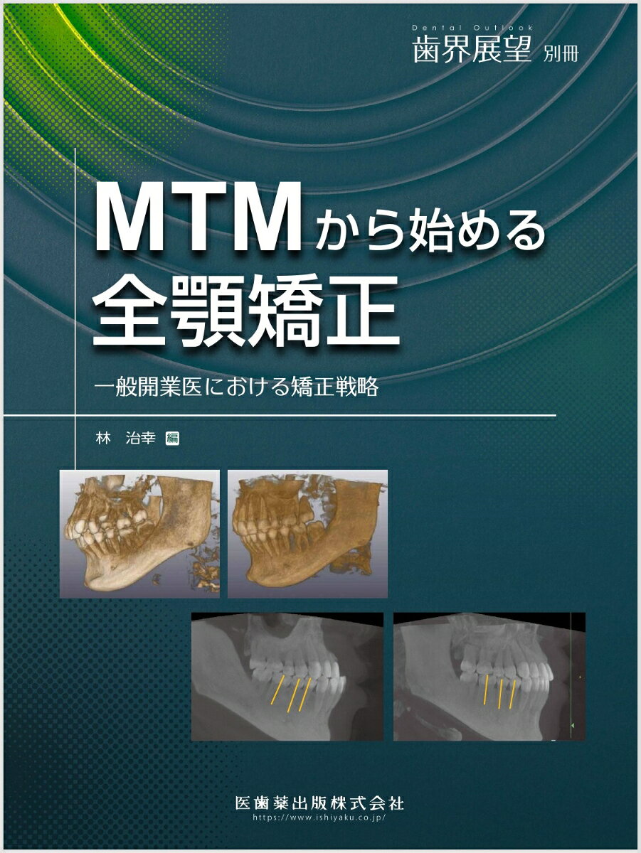 歯界展望別冊 MTMから始める全顎矯正 一般開業医における矯正戦略 [雑誌]