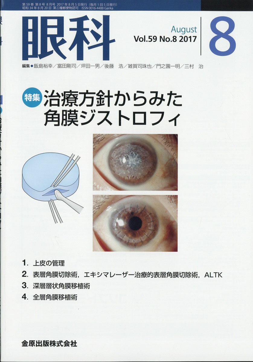 眼科 2017年 08月号 [雑誌]