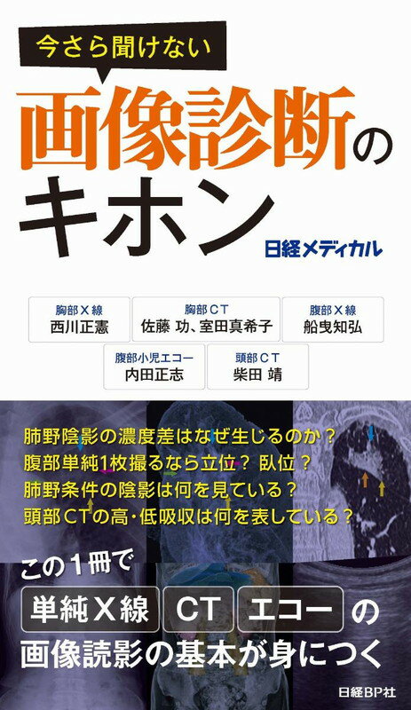 今さら他人に聞けない画像診断のイロハから、読影力のさらなる向上につながるコツまで、臨床経験も豊富なエキスパートが分かりやすく解説。この１冊で単純Ｘ線、ＣＴ、エコーの画像読影の基本が身につく。