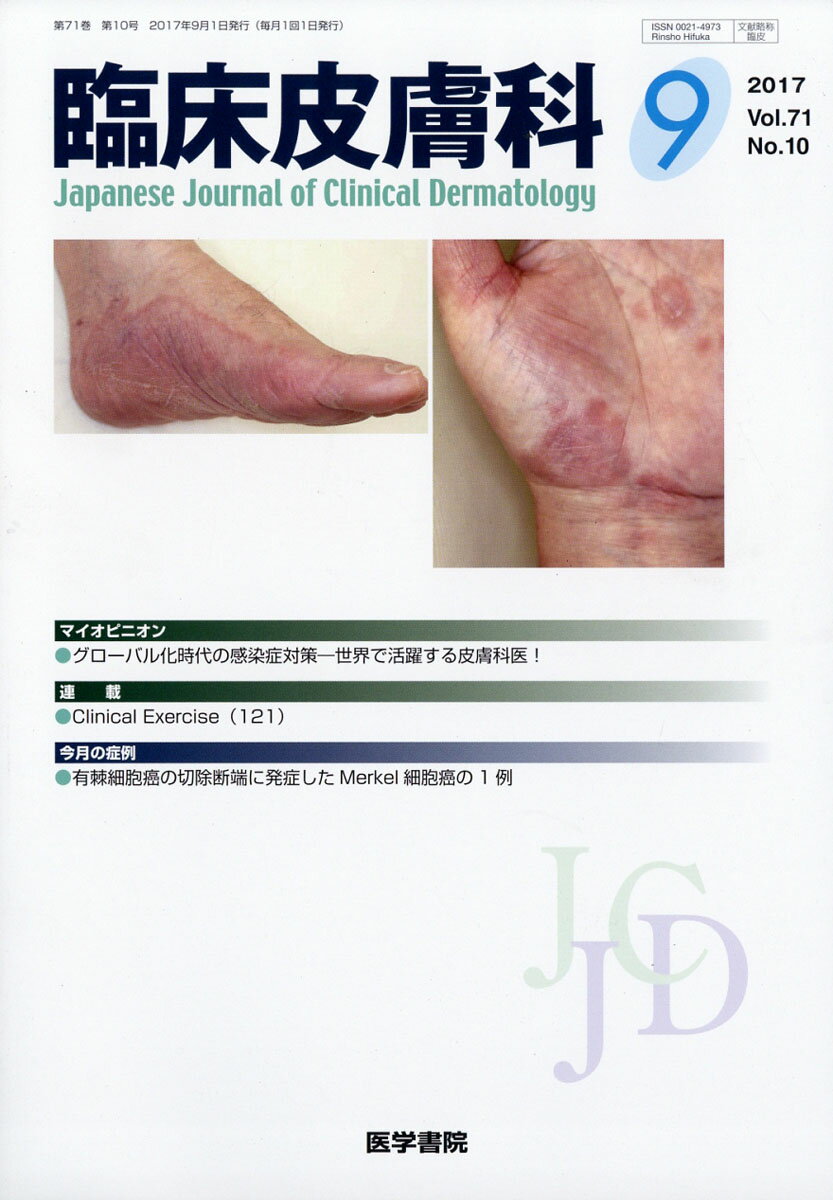 臨床皮膚科 2017年 09月号 [雑誌]
