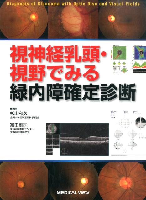 視神経乳頭・視野でみる緑内障確定診断