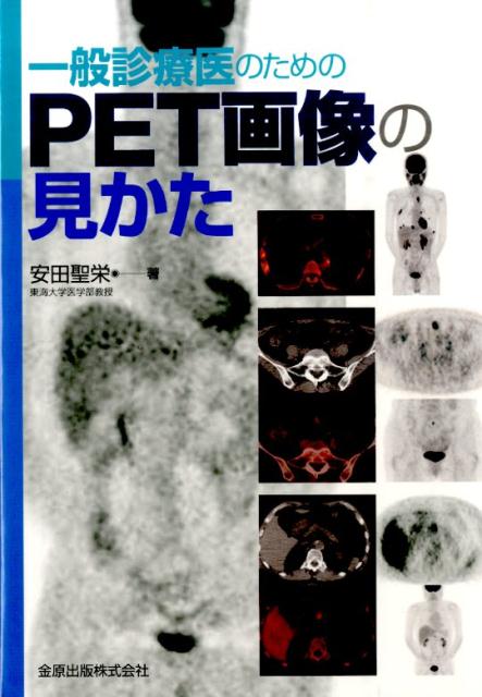 一般診療医のためのPET画像の見かた [ 安田聖栄 ]