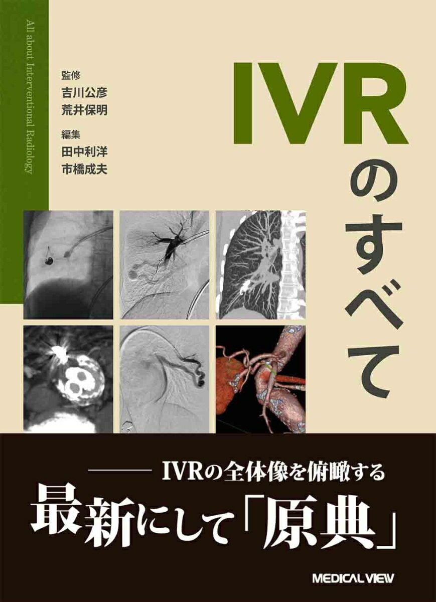 IVRのすべて