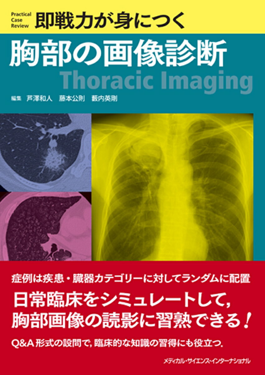 即戦力が身につく胸部の画像診断