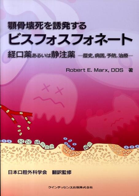 顎骨壊死を誘発するビスフォスフォネート経口薬あるいは静注薬 歴史，病因，予防，治療 [ ロバート・E．マークス ]