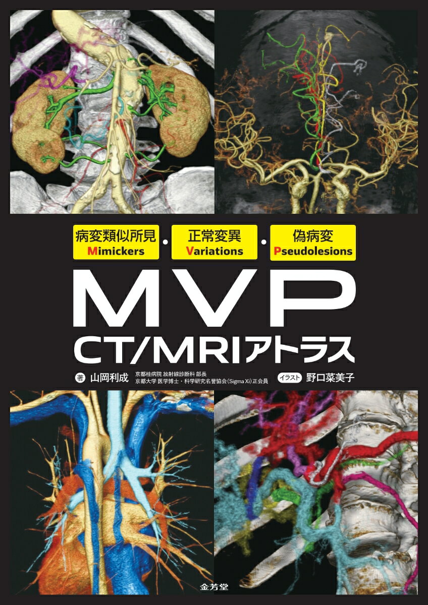 病変類似所見Mimickers・正常変異Variations・偽病変Pseudolesions　MVP CT/MRIアトラス [ 山岡利成 ]