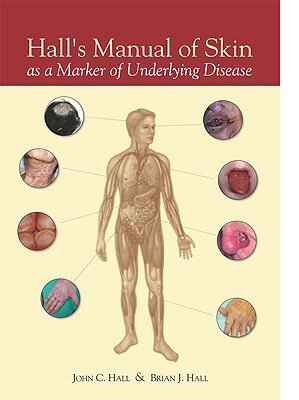 Hall's Manual of Skin as a Marker of Underlying Disease HALLS MANUAL OF SKIN AS A MARK [ John C. Hall ]