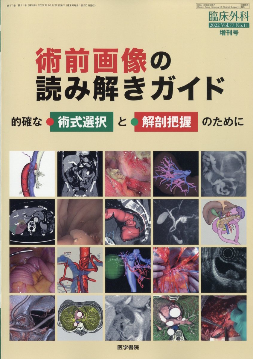 臨床外科増刊 術前画像の読み解きガイド 的確な術式選択と解剖把握のために 2022年 10月号 [雑誌]