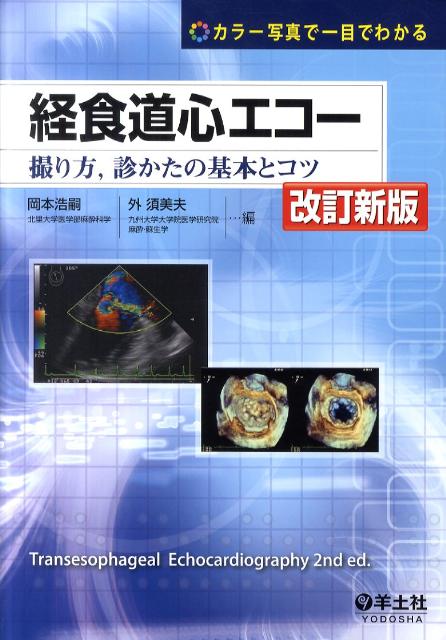 経食道心エコー改訂新版