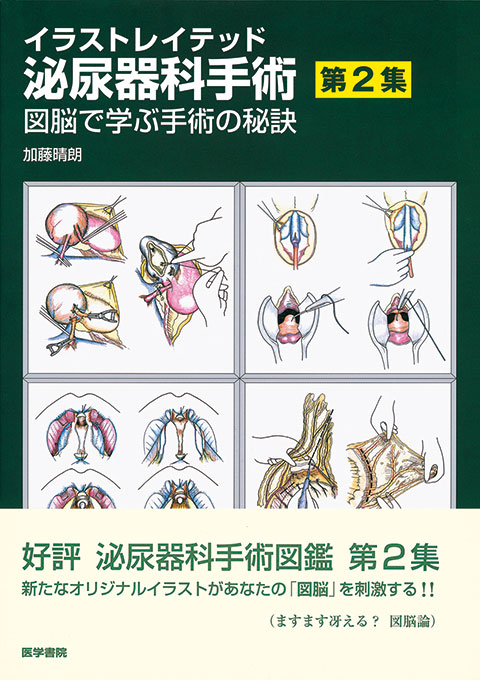 イラストレイテッド泌尿器科手術(第2集)