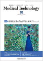 ≪本誌の特長≫
●次代を担う臨床検査技師のための総合臨床情報誌。
●臨床検査業務に即応した最新情報を、より幅広くより豊かにビジュアルな誌面で提供し、わかりやすく解説・紹介。定評ある基本技術の解説とともに、診療支援の強化やチーム医療への参加といった時代のニーズに応える知識・情報を豊富に掲載！

≪特集テーマの紹介≫
●超音波検査における患者さんの検査条件は千差万別です。体型や消化管ガス、アーチファクト、死角といったさまざまな要因により、対象とする臓器や部位がうまく抽出されず、観察に苦慮することも少なくありません。
●本特集では、『超音波検査の「抽出不良」解決テクニック』と題して、腹部領域（肝臓/胆嚢・胆管/膵臓/消化管）、心臓、頸動脈、下肢静脈での「抽出不良」について、考え方や具体的な対策・工夫を解説しています。

【目次】
1．腹部領域
　1）肝臓
　2）胆嚢・胆管
　3）膵臓
　4）消化管
2．心臓
3．頸動脈
4．下肢静脈

■Editorial-今月のことば
　経験を経験知に

■話題ーNEWS&TOPICS
　国際規格ISO　15189の改定（第4版）ポイント

■間葉系幹細胞の再生医療への応用展開と標準化

■基礎講座
　シリーズー腫瘍マーカーの免疫染色
　第2回　臓器・組織特異的なマーカーと治療の決定に活用されるマーカー
　抗凝固剤と凝固促進剤の基礎知識

■アプローチ別に学ぶ！微生物検査室のAS貢献
　4．薬剤感受性試験

■FOCUS
　分子生物学的手法を用いた菌血症診断技術

■MT Seminar
　造血幹細胞移植での輸血療法

■メディカルスタッフ職業図鑑
　10．視能訓練士

■臨床検査Q&A
　検体（血清や血漿）が足りない時に、他の検体で代用することは可能でしょうか？
　肝機能が悪くなると、血球内に脂肪が取り込まれ、通常の溶血剤では溶けにくくなると聞きました。各メーカーがいろいろと工夫しているようですが、溶血不良の場合、どのような検査データになるか教えて下さい。

■学会レビュー
　第64回日本臨床細胞学会総会春期大会