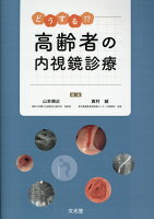 どうする！？高齢者の内視鏡診療