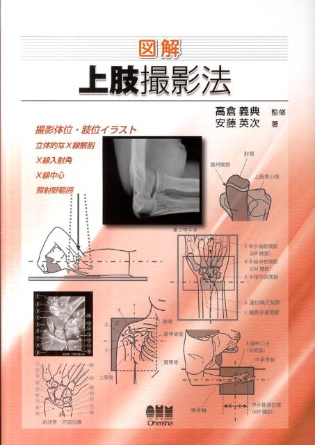 図解上肢撮影法