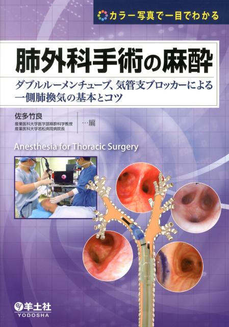 ダブルルーメンチューブ、気管支ブロッカーの種類と特徴、選び方、実際の麻酔手技のコツ、呼吸器の解剖や呼吸生理に基づく周術期管理のポイント…など、豊富なカラー写真＆イラストで一側肺換気の重要ポイントをビジュアルに解説。ほかでは学べない実際の手術で役立つコツやアドバイスが満載！