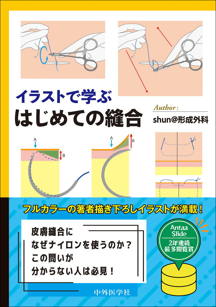イラストで学ぶ はじめての縫合