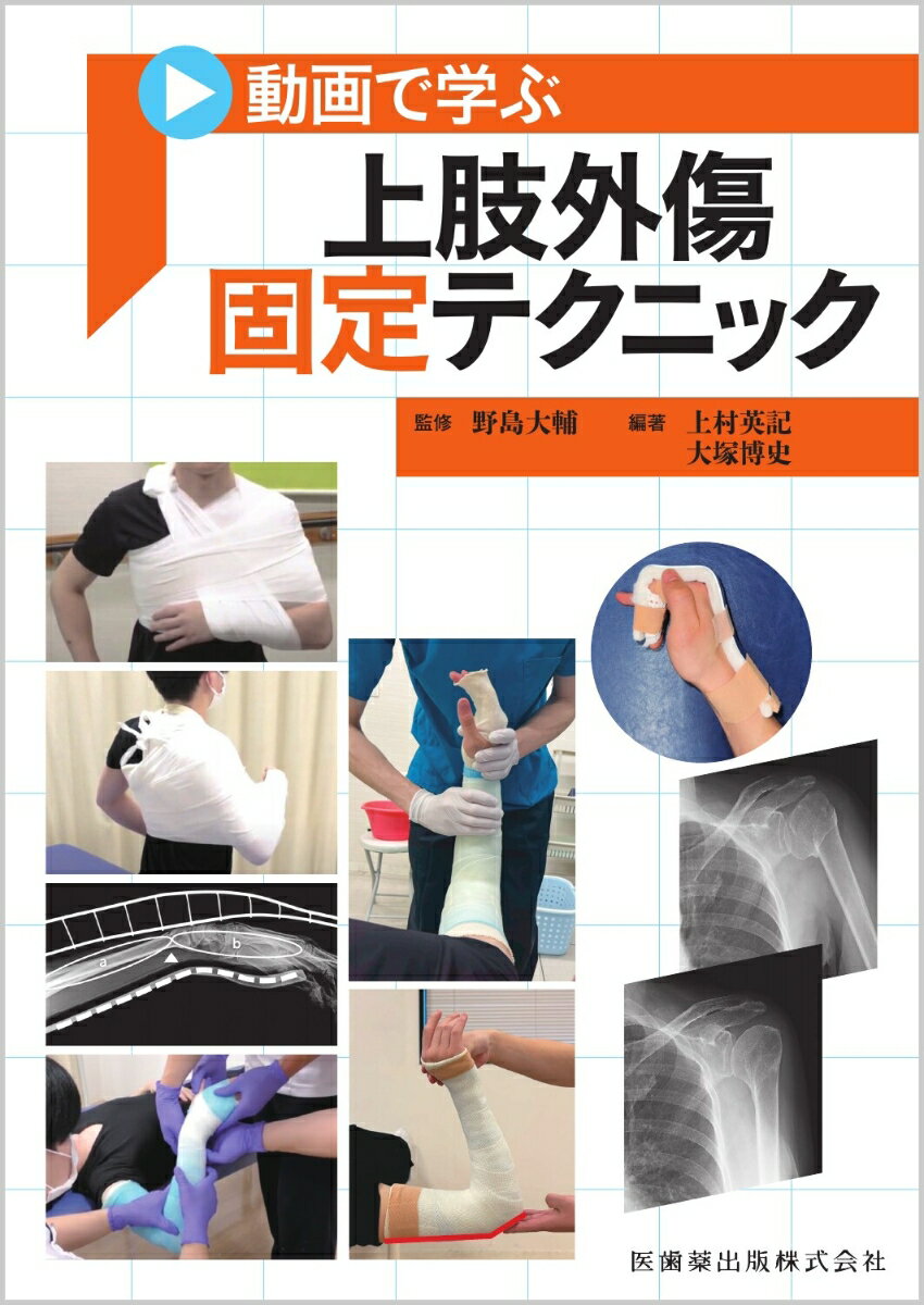 動画で学ぶ 上肢外傷固定テクニック