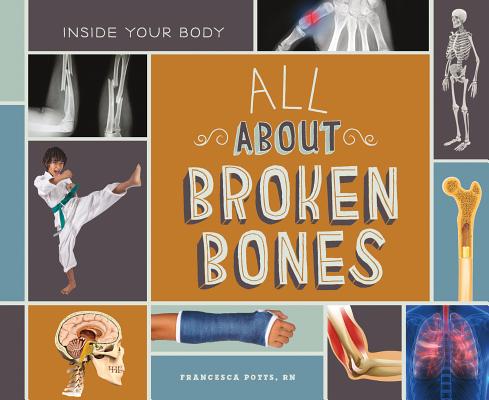 All about Broken Bones ALL ABT BROKEN BONES （Inside Your Body Set 1） [ Francesca Potts ]