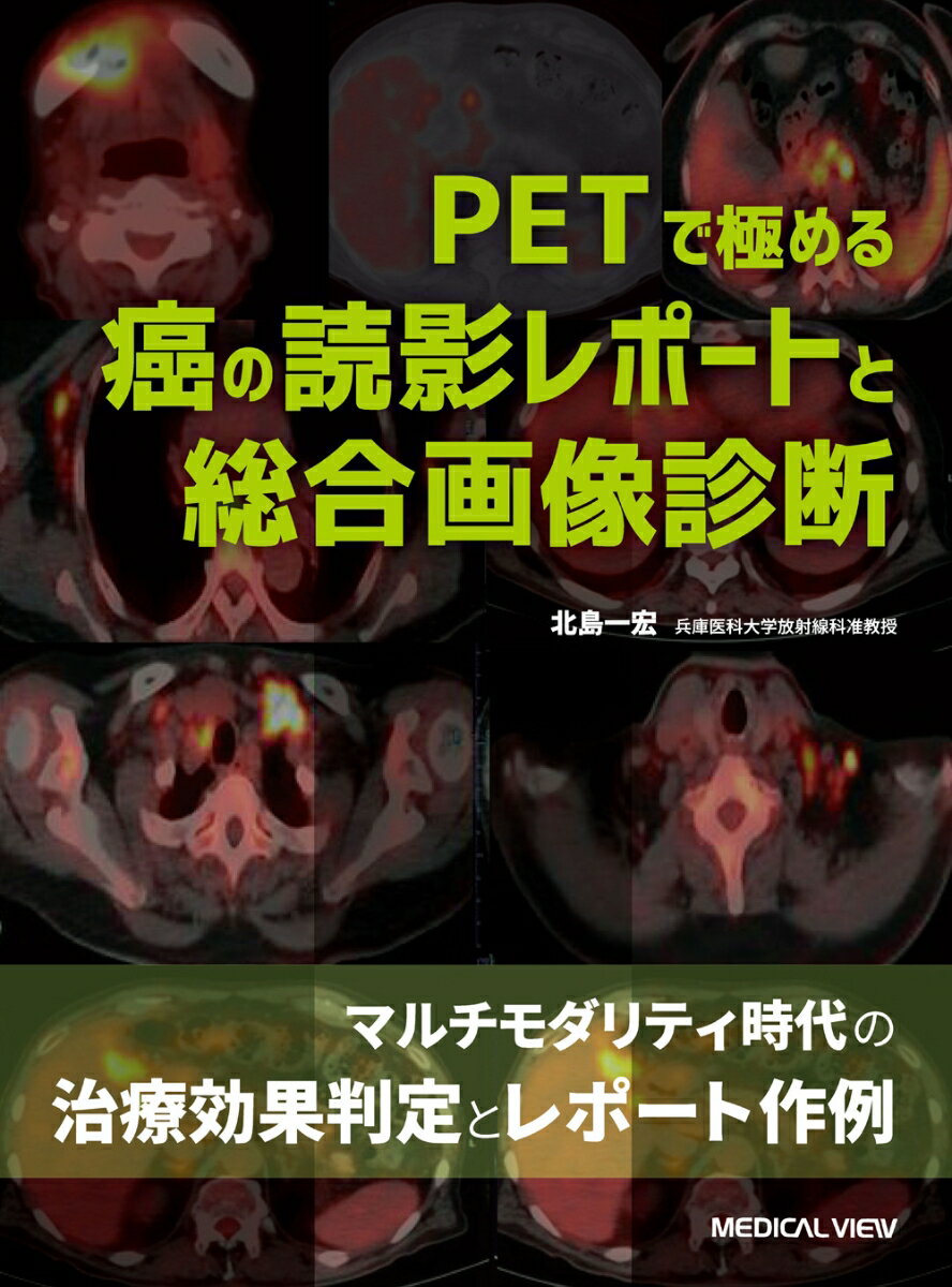 PETで極める 癌の読影レポートと総合画像診断 [ 北島 一宏 ]