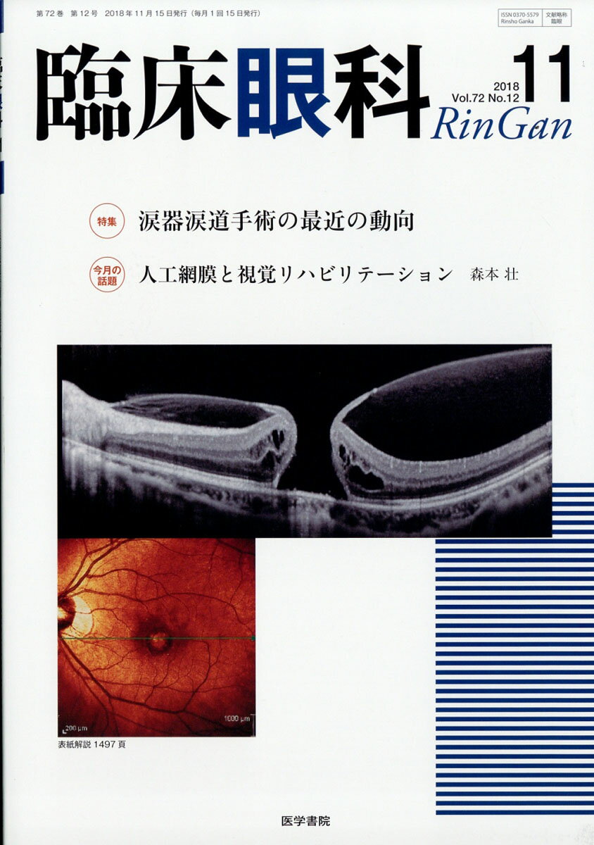 臨床眼科 2018年 11月号 [雑誌]