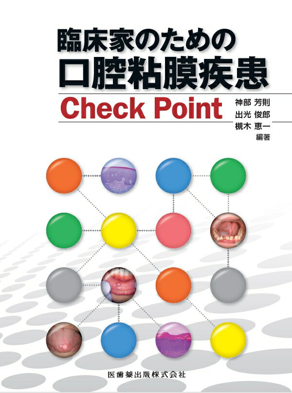 臨床家のための口腔粘膜疾患Check　Point