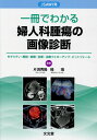 一冊でわかる婦人科腫瘍の画像診断 JSAWI発　モダリティ・解剖・病理・診断・治療フ 