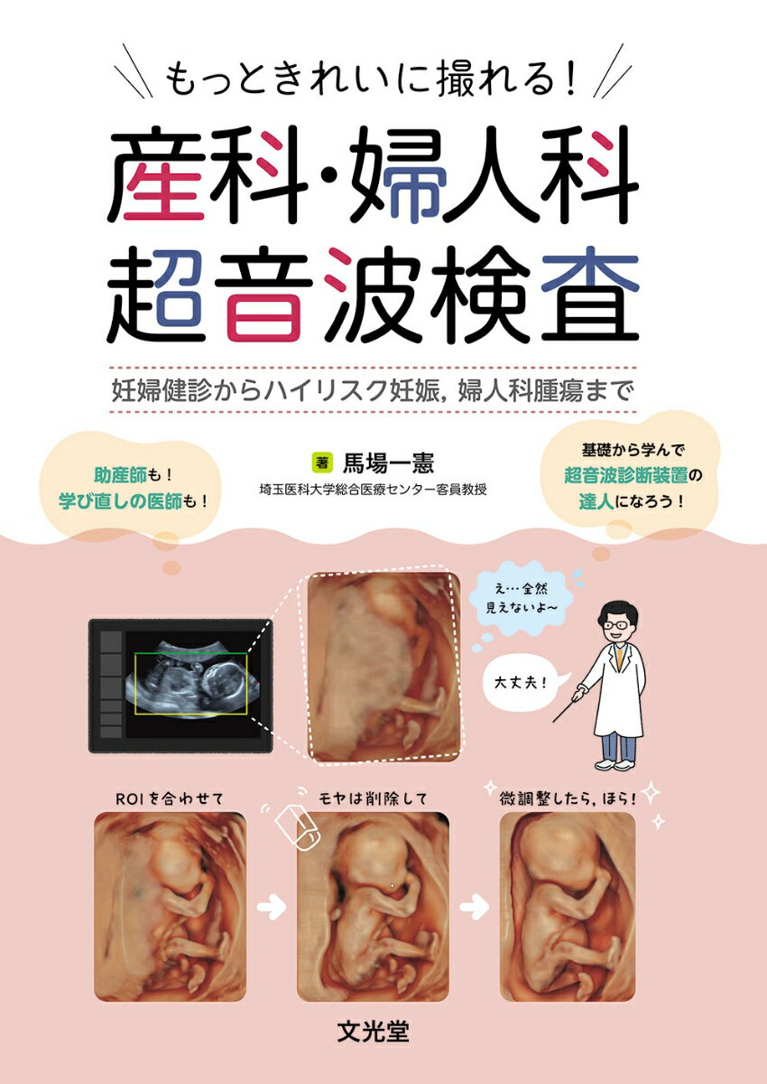 もっときれいに撮れる！産科・婦人科超音波検査 妊婦健診からハイリスク妊娠，婦人科腫瘍まで