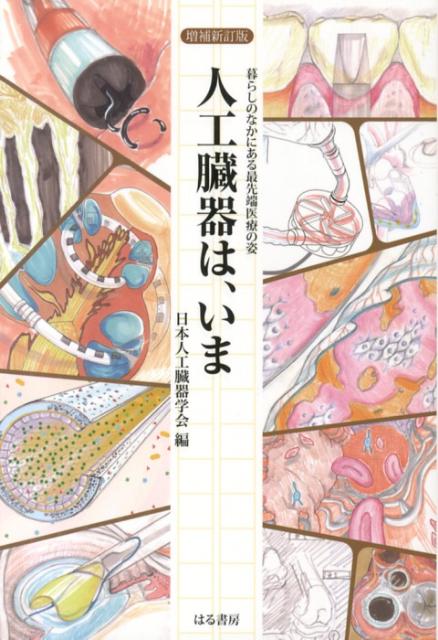 人工臓器は、いま増補新訂版 暮らしのなかにある最先端医療の姿 [ 日本人工臓器学会 ]