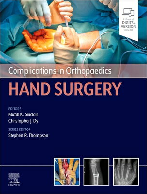 Complications in Orthopaedics: Hand Surgery COMPLICATIONS IN ORTHOPAEDICS （Complications in Orthopaedics） 