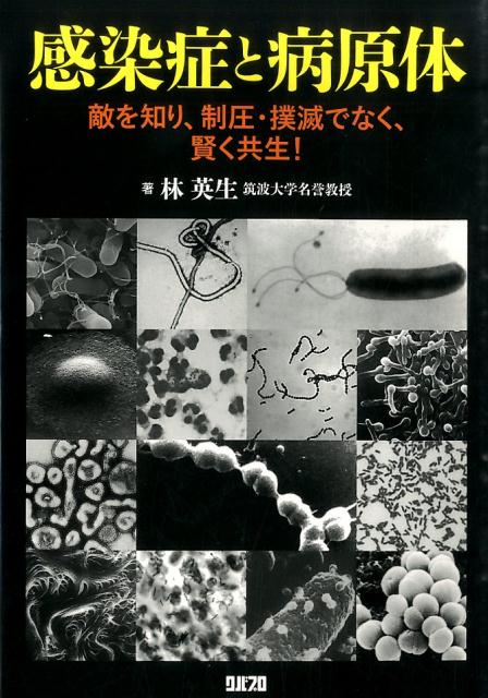 感染症と病原体