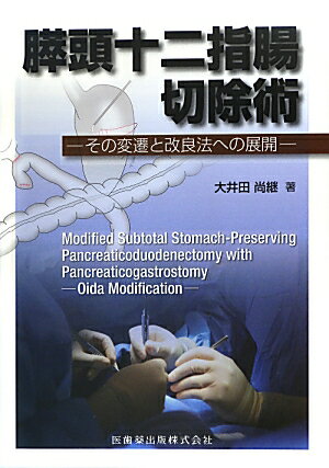 膵頭十二指腸切除術 その変遷と改良法への展開 [ 大井田尚継 ]