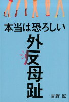 本当は恐ろしい外反母趾