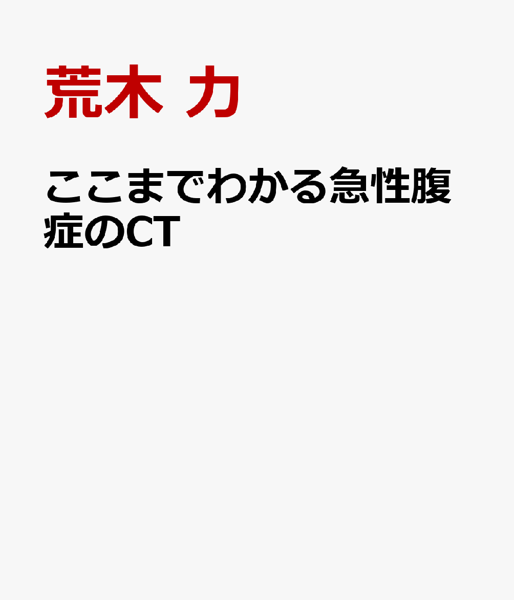 ここまでわかる急性腹症のCT