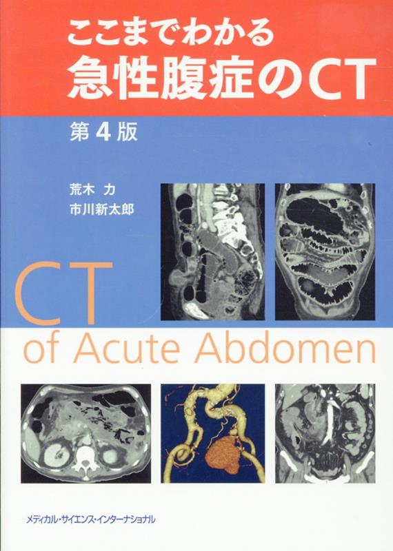 ここまでわかる急性腹症のCT / 荒木　力・市川　新太郎