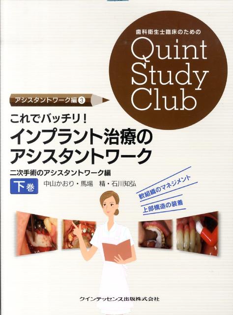 これでバッチリ！インプラント治療のアシスタントワーク（下巻）