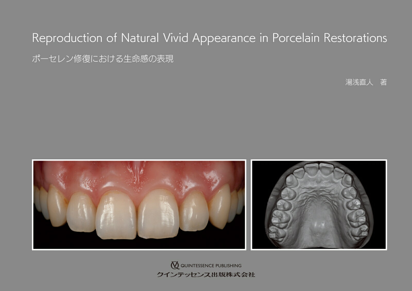 ポーセレン修復における生命感の表現 [ 湯浅直人 ]