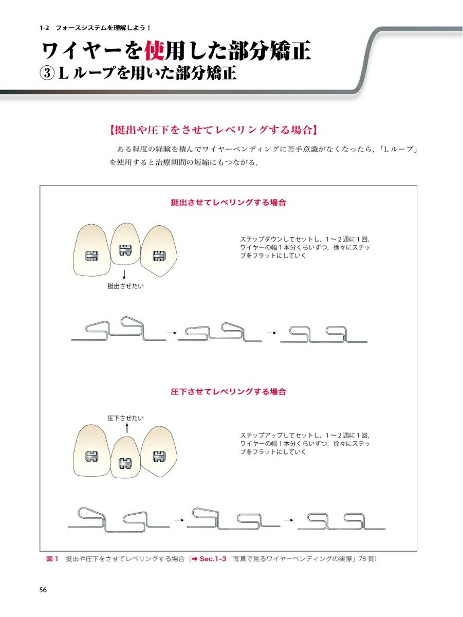 イラストと症例で学ぶ 開業医のための臨床部分矯正 咬合育成から補綴前矯正まで [ 徳永 哲彦 ] 2
